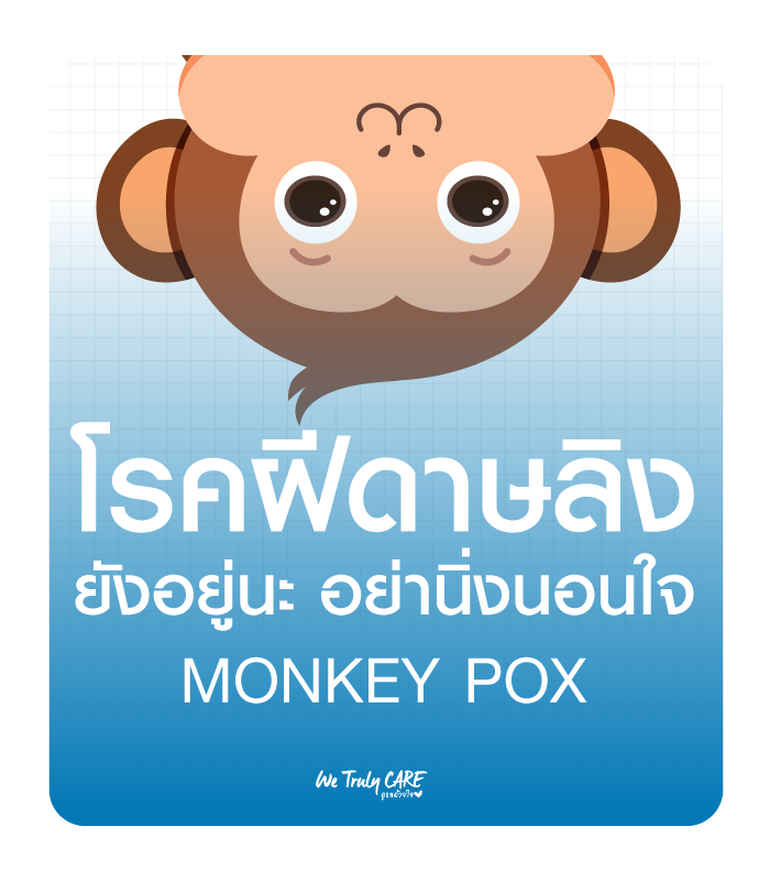 Monkeypox Virus