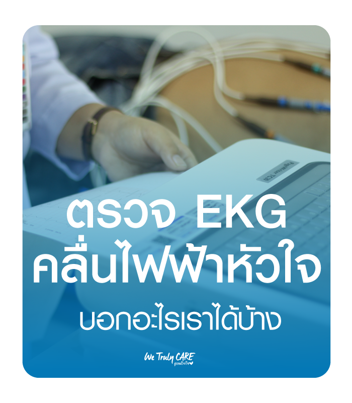What is an EKG